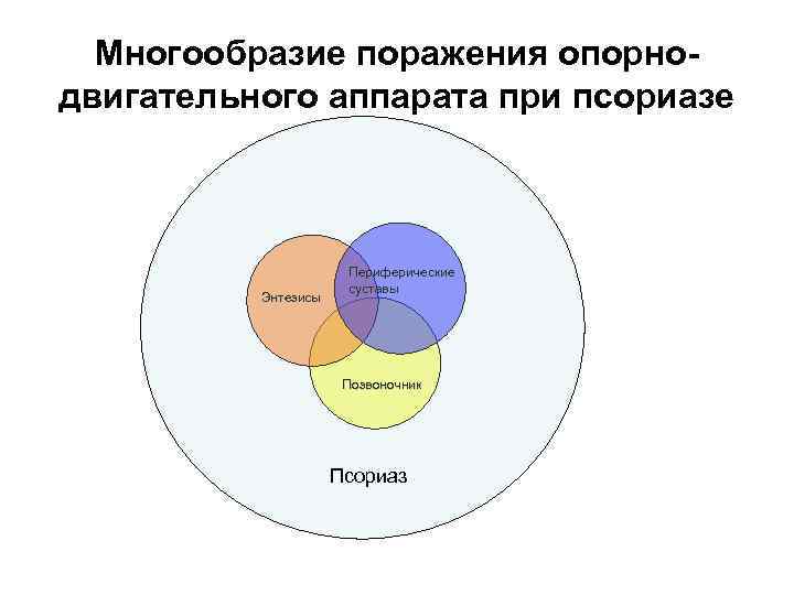  Многообразие поражения опорно- двигательного аппарата при псориазе     Периферические 