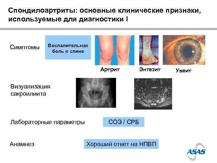 Схема лечения воспаления придатков