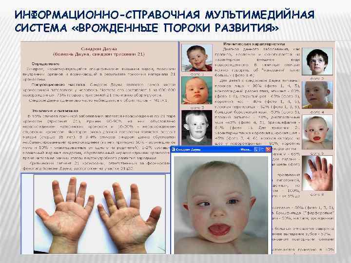 ИНФОРМАЦИОННО-СПРАВОЧНАЯ МУЛЬТИМЕДИЙНАЯ СИСТЕМА «ВРОЖДЕННЫЕ ПОРОКИ РАЗВИТИЯ» 