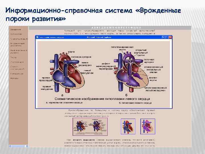 Информационно-справочная система «Врожденные пороки развития» 