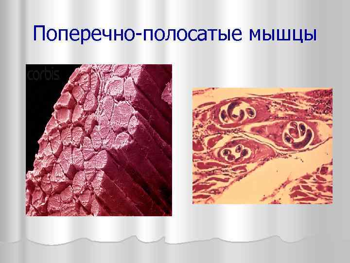 Поперечно-полосатые мышцы 