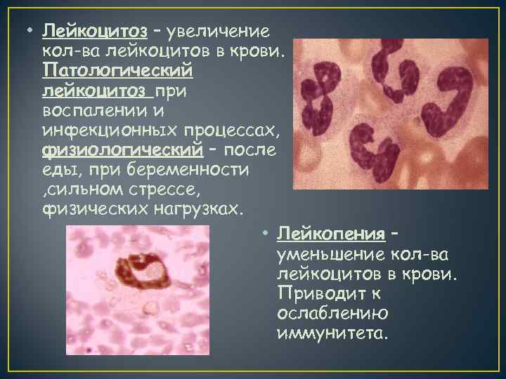  • Лейкоцитоз – увеличение  кол-ва лейкоцитов в крови.  Патологический  лейкоцитоз