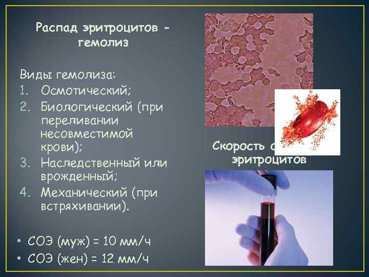  Распад эритроцитов -   гемолиз Виды гемолиза: 1. Осмотический; 2. Биологический (при
