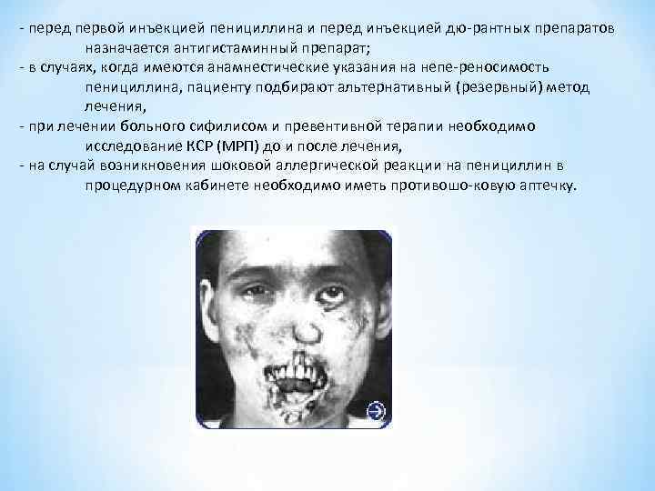 перед первой инъекцией пенициллина и перед инъекцией дю рантных препаратов назначается антигистаминный перед первой инъекцией пенициллина и перед инъекцией дю рантных препаратов назначается антигистаминный