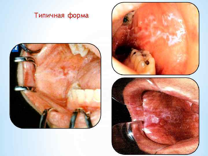 Типичная форма 