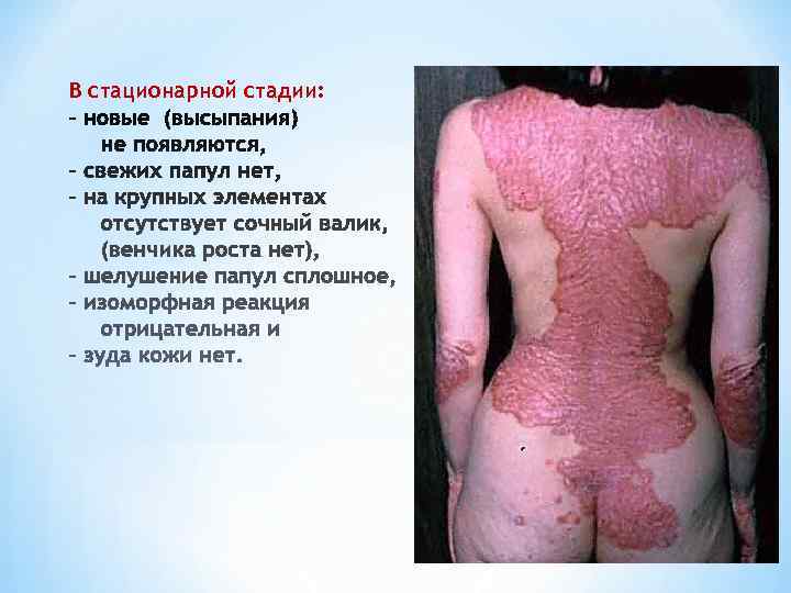 В стационарной стадии: 