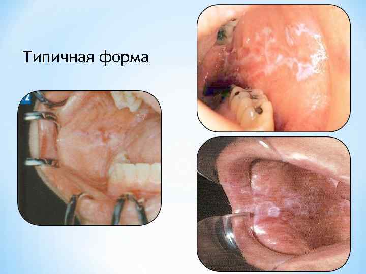 Типичная форма 