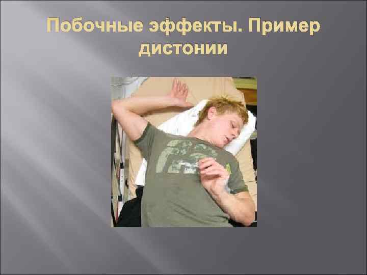 Побочные эффекты. Пример   дистонии 