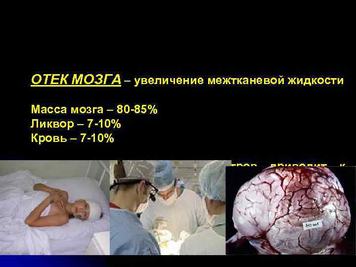   ОТЕК МОЗГА – увеличение межтканевой жидкости Масса мозга – 80 85% 
