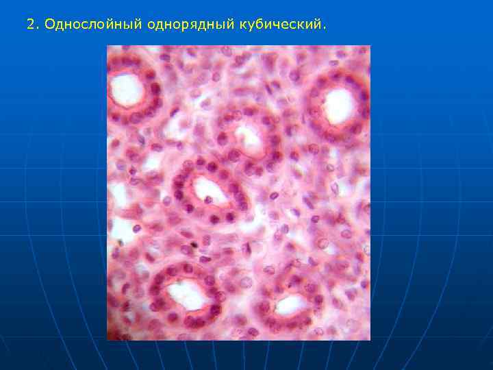 2. Однослойный однорядный кубический. 