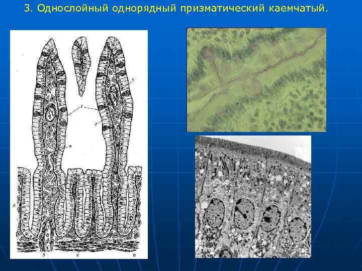 3. Однослойный однорядный призматический каемчатый. 