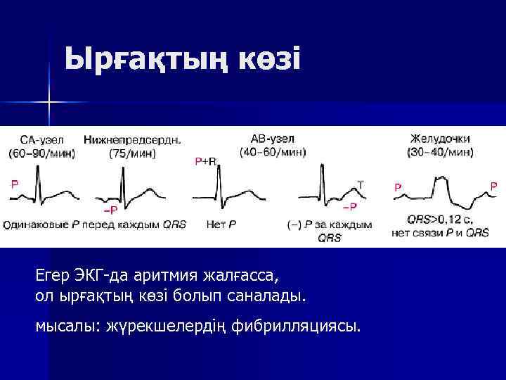   Ырғақтың көзі Егер ЭКГ да аритмия жалғасса,  ол ырғақтың көзі болып