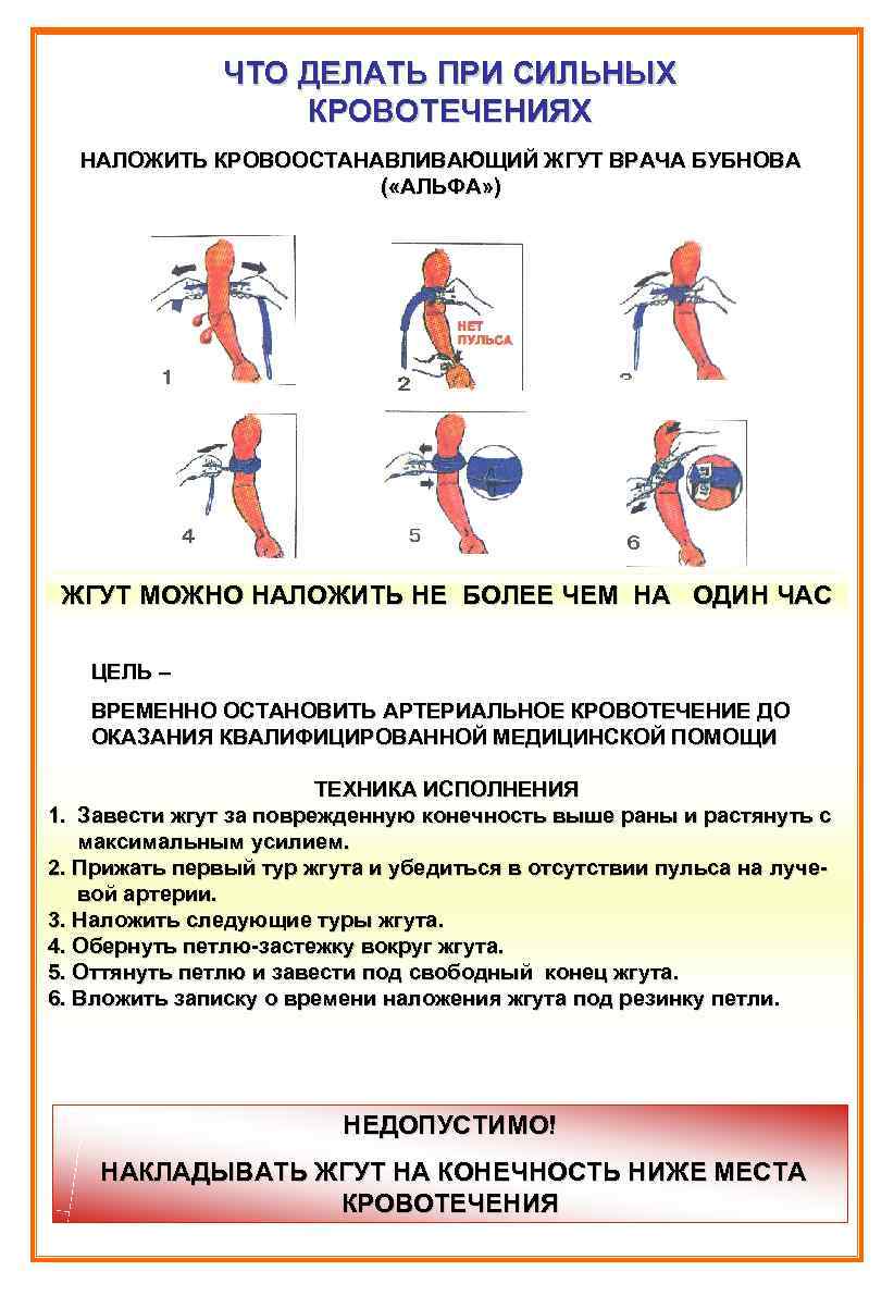 Что нельзя при кровотечении. Что делать при кровотечении. Накладывается жгут при сильном кровотечении.