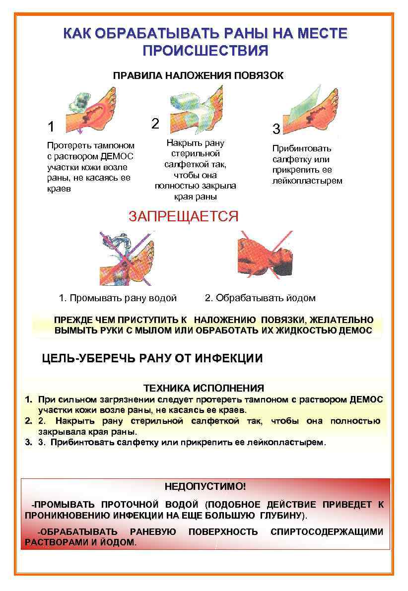 Обработка ран. Порядок обработки раны. Обработка открытой раны.