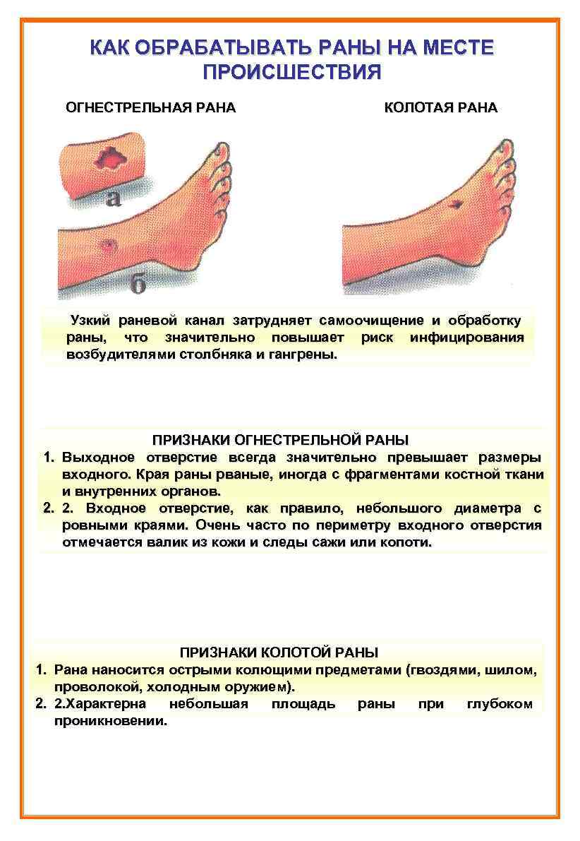 Как правильно обработать рану