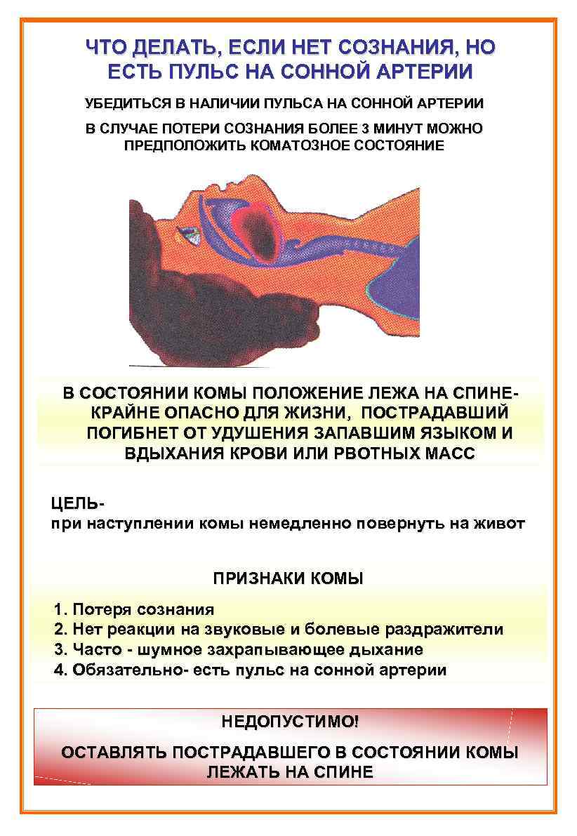 Пульс при потере сознания. Если нет сознания но есть пульс на сонной артерии. Если нет сознания но есть пульс. Что делать если у человека нет пульса.