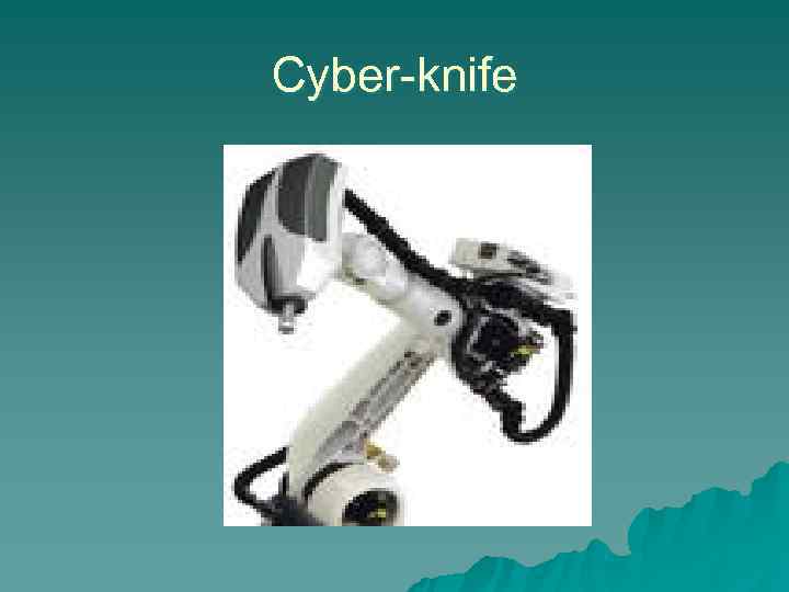 Cyber-knife 
