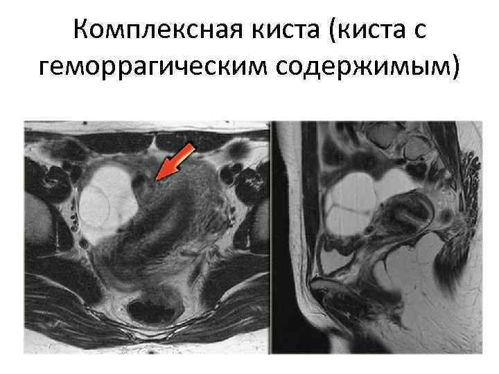 Органы малого таза у женщин что входит картинка