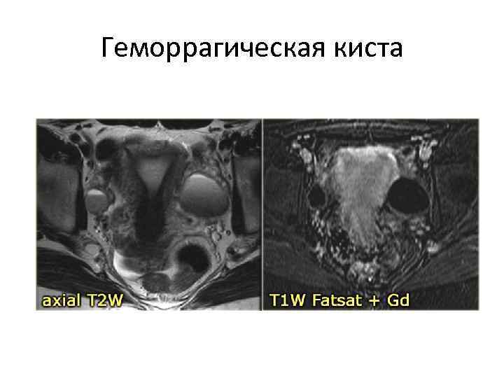 Органы малого таза у женщин расположение фото спереди с обозначениями на русском