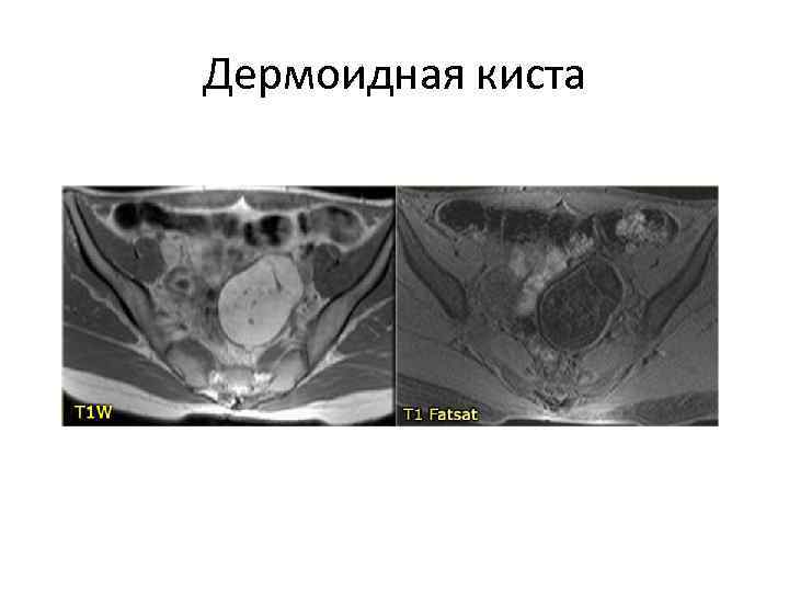 Органы малого таза у женщин что входит картинка