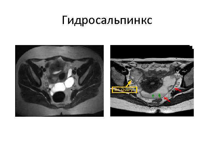 Женские органы малого таза строение в картинках