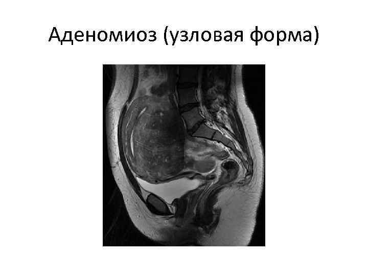 Органы малого таза у женщин что входит картинка