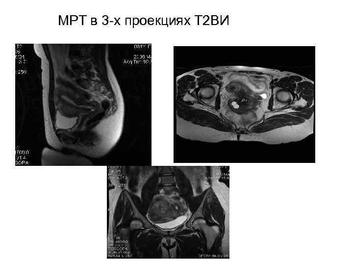 Органы малого таза у женщин что входит картинка