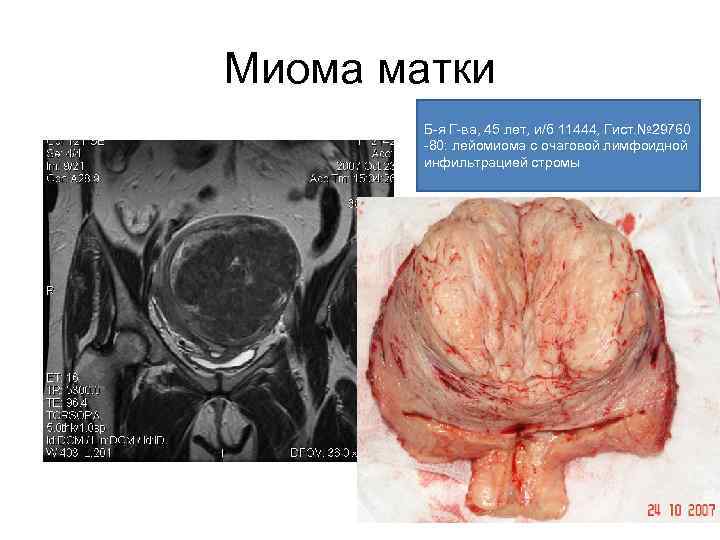 Схема женских органов малого таза