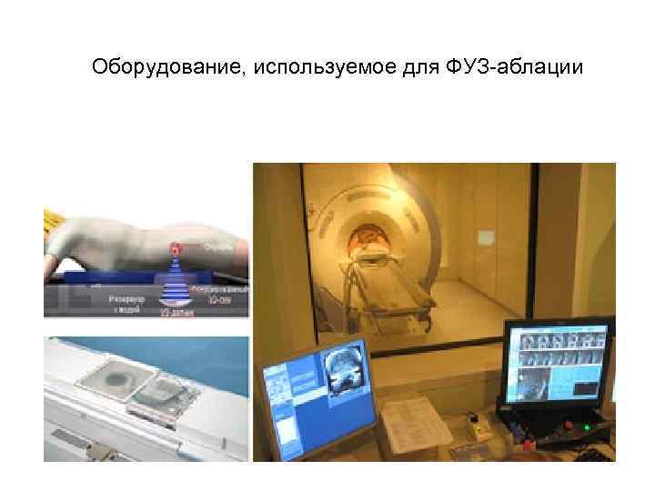 Оборудование, используемое для ФУЗ-аблации 