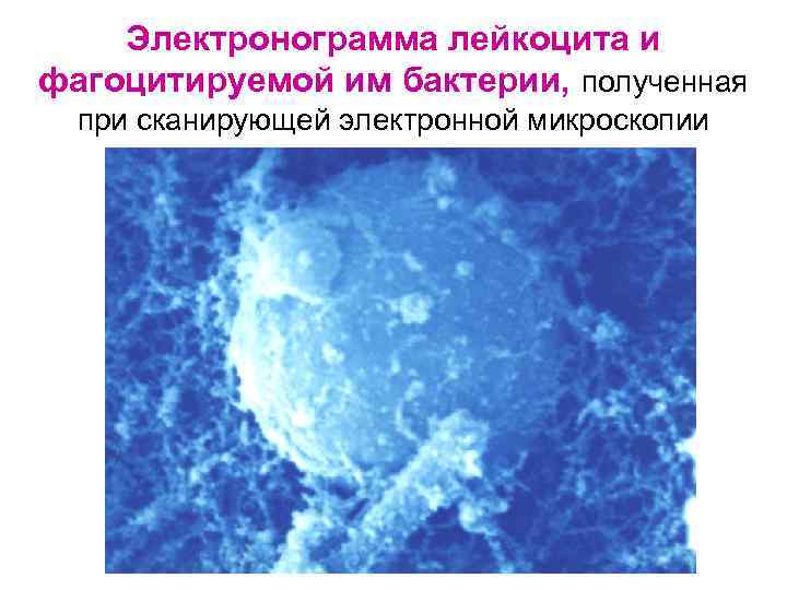  Электронограмма лейкоцита и фагоцитируемой им бактерии, полученная  при сканирующей электронной микроскопии