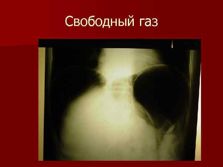 Свободный газ Свободный газ