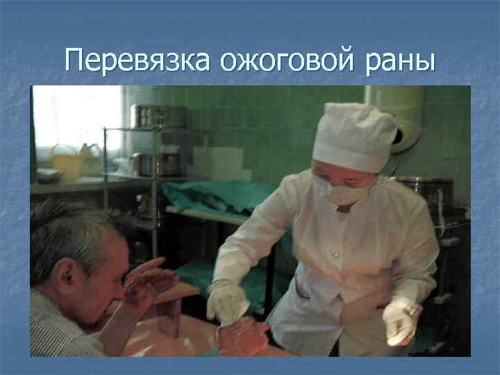 Перевязка ожоговой раны 