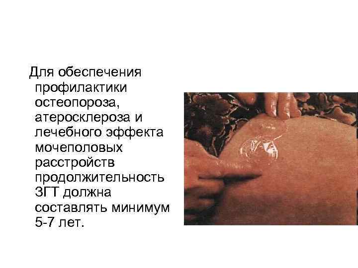 Для обеспечения профилактики остеопороза, атеросклероза и лечебного эффекта мочеполовых расстройств продолжительность ЗГТ должна Для обеспечения профилактики остеопороза, атеросклероза и лечебного эффекта мочеполовых расстройств продолжительность ЗГТ должна