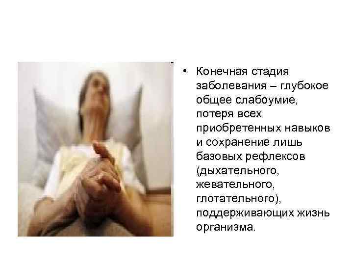 • Конечная стадия заболевания – глубокое общее слабоумие, потеря всех • Конечная стадия заболевания – глубокое общее слабоумие, потеря всех