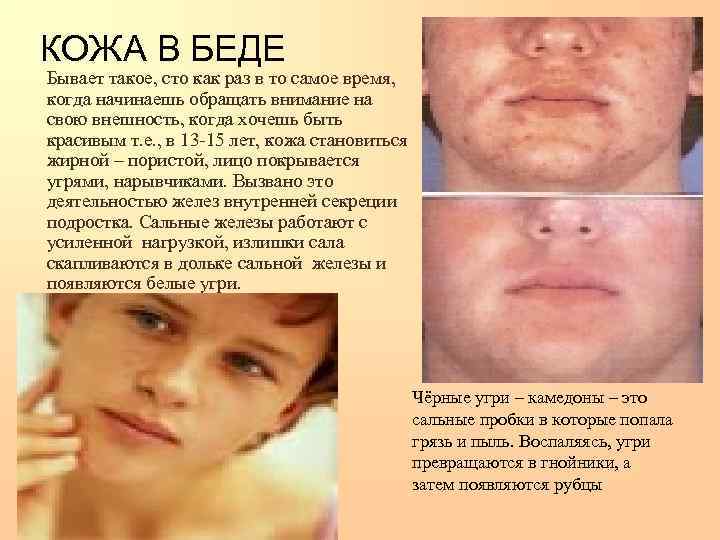 КОЖА В БЕДЕ Бывает такое, сто как раз в то самое время,  когда