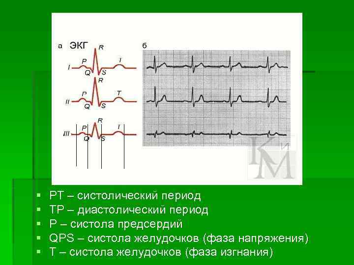 §  РТ – систолический период §  ТР – диастолический период § 