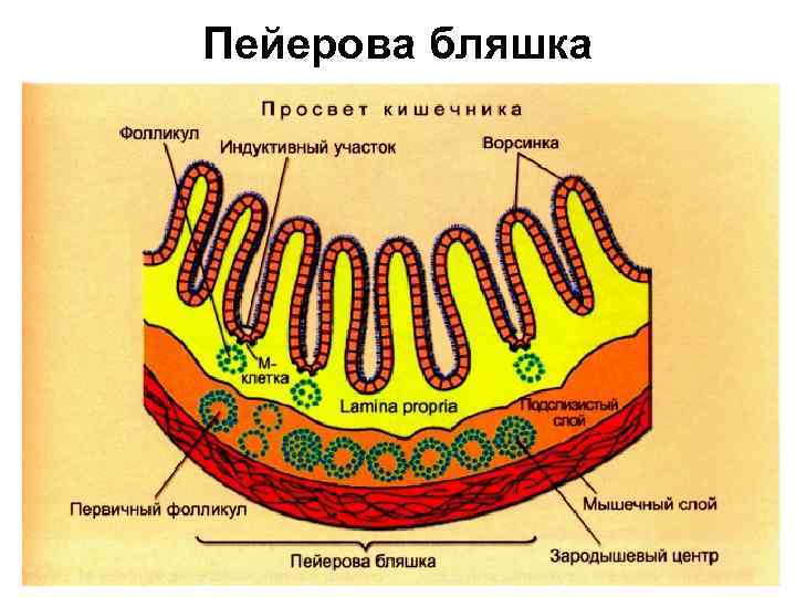 Пейерова бляшка 