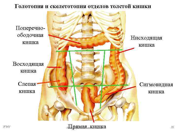 Проекция слепой кишки