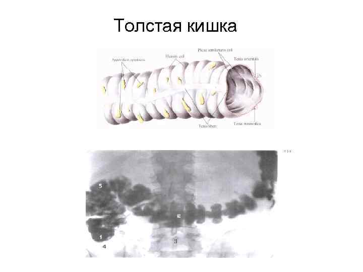 Толстая кишка 