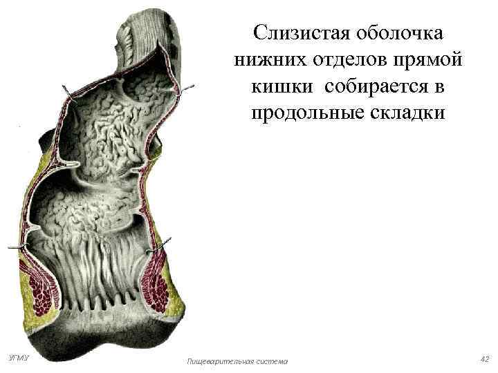 Рак нижнеампулярного отдела прямой кишки