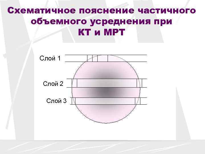 Схематичное пояснение частичного объемного усреднения при   КТ и МРТ  Слой 1