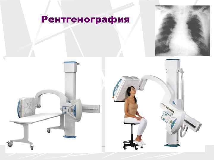 Рентгенография с прямым увеличением изображения применяется