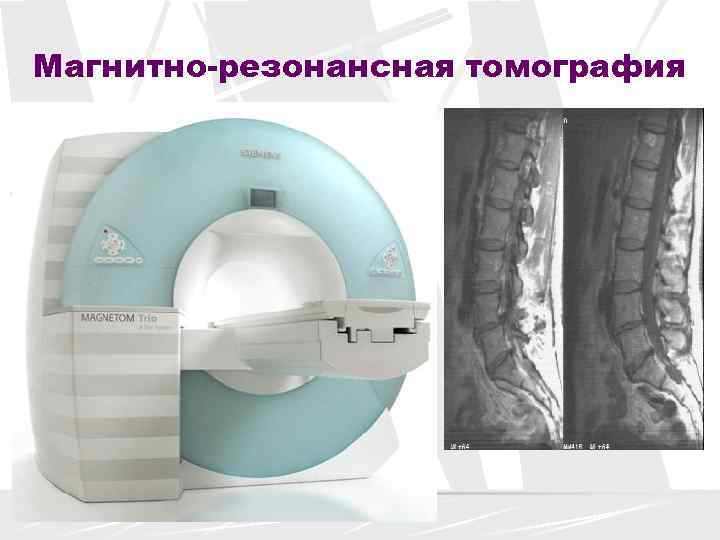 Магнитно-резонансная томография 