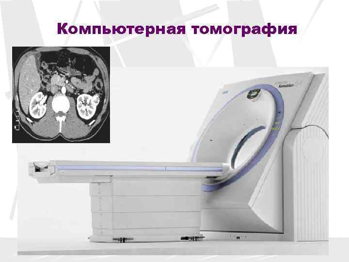 Компьютерная томография 