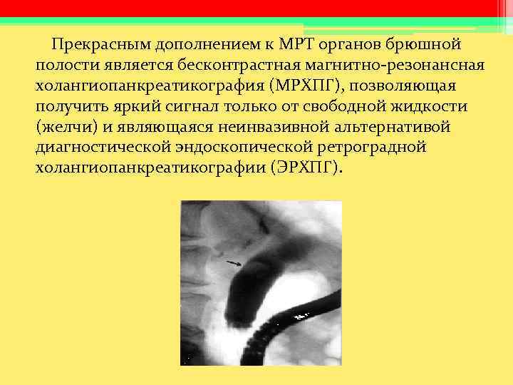 Прекрасным дополнением к МРТ органов брюшной полости является бесконтрастная магнитно-резонансная холангиопанкреатикография (МРХПГ), позволяющая Прекрасным дополнением к МРТ органов брюшной полости является бесконтрастная магнитно-резонансная холангиопанкреатикография (МРХПГ), позволяющая