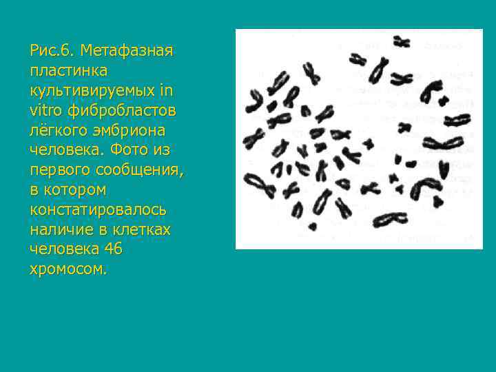 Рис. 6. Метафазная пластинка культивируемых in vitro фибробластов лёгкого эмбриона человека. Фото из первого