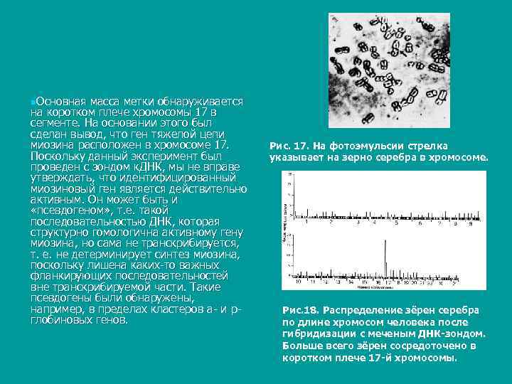 n. Основная  масса метки обнаруживается на коротком плече хромосомы 17 в сегменте. На
