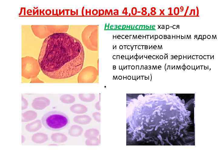 Лейкоциты (норма 4, 0 -8, 8 х 109/л)      Незернистые