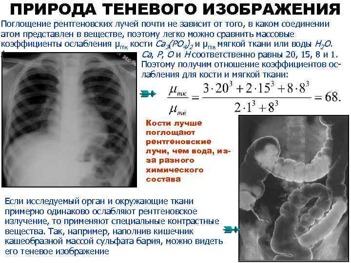 Естественный радиационный фон в рентгенах