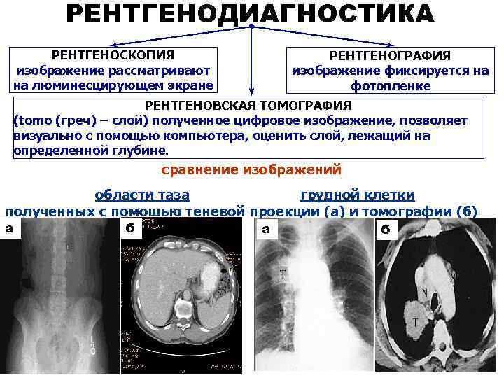 Нормальный радиационный фон в микрорентген